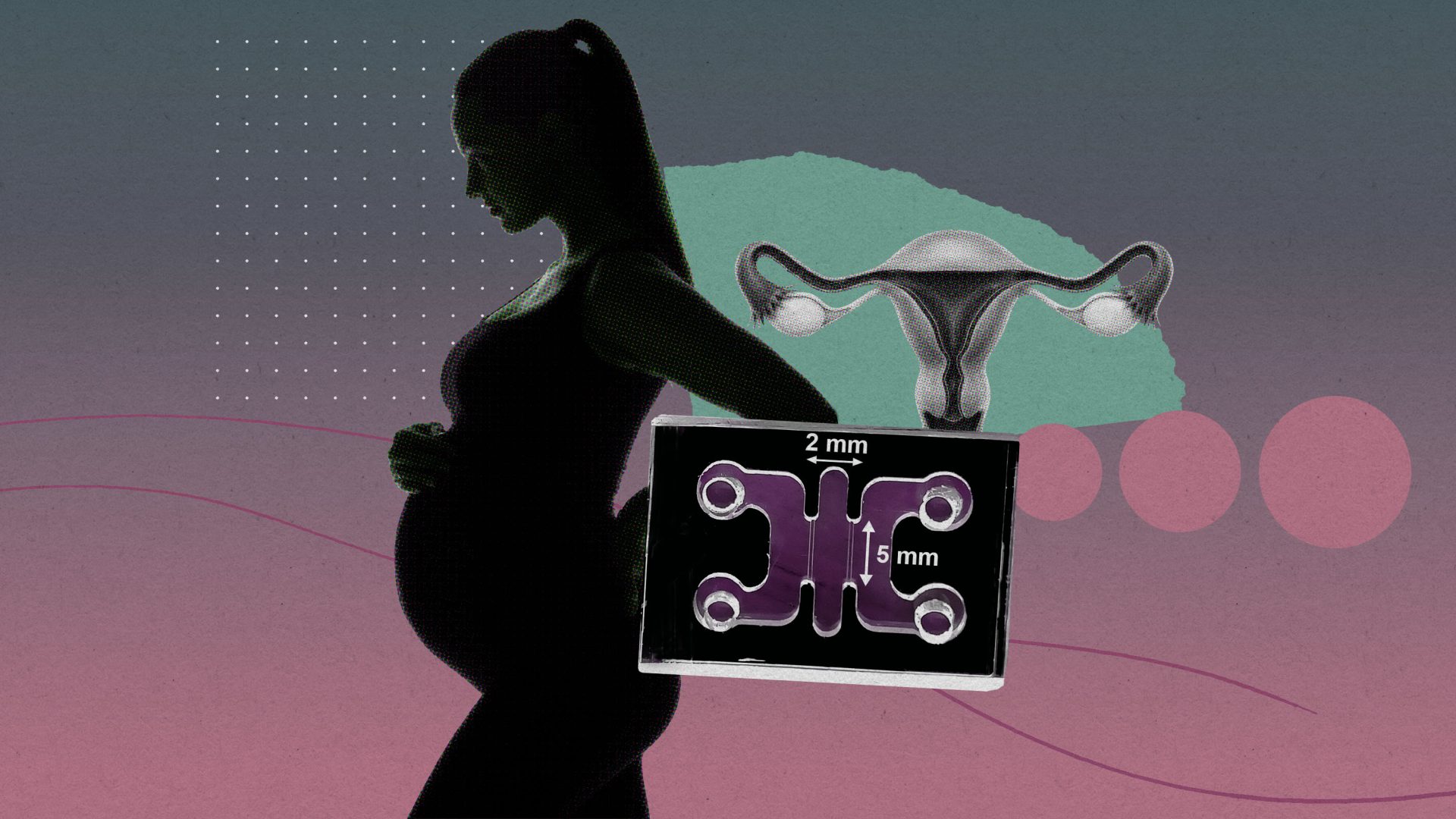 En este momento estás viendo 
<span class="bsf-rt-reading-time"><span class="bsf-rt-display-label" prefix="Tiempo de lectura"></span> <span class="bsf-rt-display-time" reading_time="1"></span> <span class="bsf-rt-display-postfix" postfix="mins"></span></span><!-- .bsf-rt-reading-time -->La descarga: imitación de los primeros momentos del embarazo en un laboratorio y explicación de los parámetros de la IA