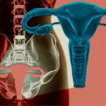 Por primera vez se mantiene vivo el útero de una mujer fuera del cuerpo